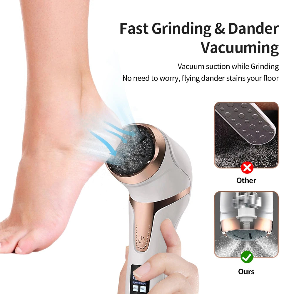 Electronic Foot Files Portable Electric Foot Callus Remover Foot Care Tool for Dead Hard Skin Rechargeable Pedicure Tools - Supersell